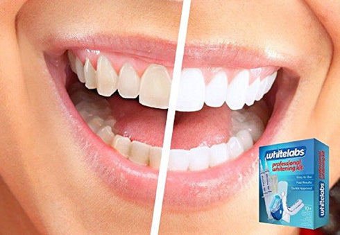 Reach Whitelabs At Home Professional Teeth Whitening Kit