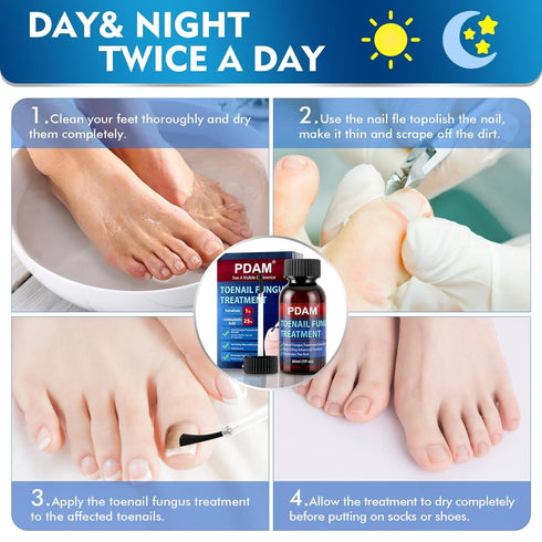 PDAM 30ml Toenail Fungus Treatment Extra Strength - Toe Nail Fungus Treatments for Thick, Nail Strengthener and Growth