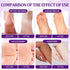 Pedicure Kit Foot Soak Set, 4 Step Foot Spa Kit with Bubble Salt, Sugar Scrub, Massage Mask, and Lotion (Lavender)