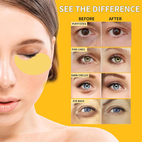 24K Gold Eye Masks for Dark Circles & Puffiness - 70PCS Under Eye Patches with Caffeine, Hyaluronic Acid, Peptides