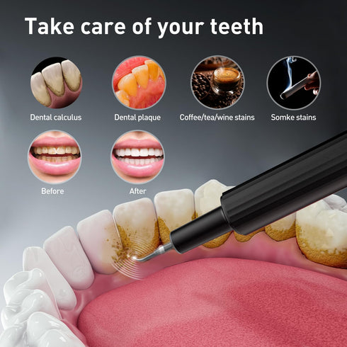 YSHTKS 4 4 IPX6 Plaque Remover for Teeth - Tartar Remover for Teeth, Dental Calculus Remover Teeth Cleaning Kit Speed