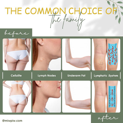 Ginger Soap Lymphatic Drainage Pack 3 - Anti-Cellulite Skin Tightening - Natural Ingredients Detox Soaps for Deep Clean