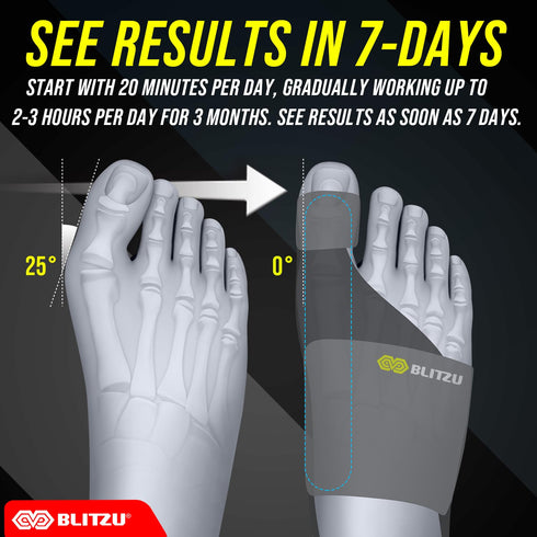 BLITZU Bunion Corrector for Women and Men, Orthopedic Bunion Splint, Big Toe Separator Pain Relief (2 Count)