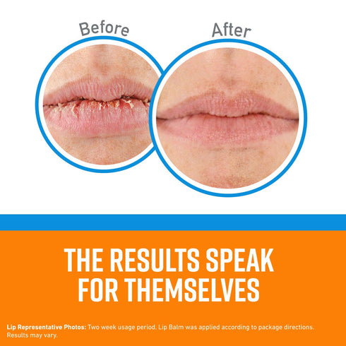 O'Keeffe's Lip Repair Cooling Relief Lip Balm Stick for Dry, Cracked Lips (Pack of 3)