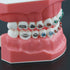 Dental Models Orthodontic Model M7010-2, 1:1 Standard Typodont Teeth with Archwire Ligature Ties, Metal Brackets