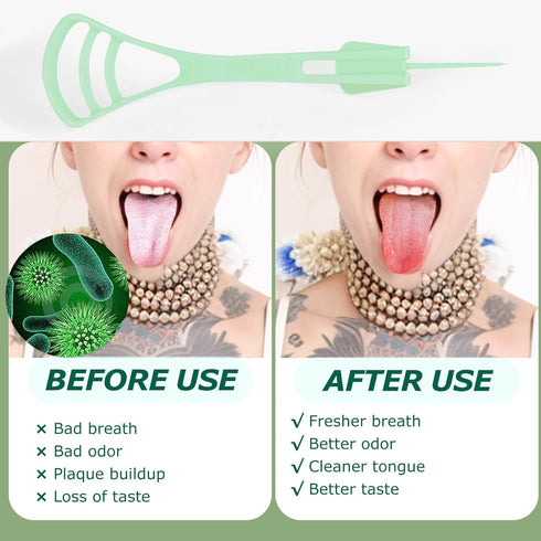100 Counts Disposable Tongue Scraper with Dental Picks, BPA Free Plastic Tongue Cleaner Scrapers for Fresh Breath