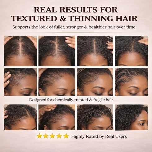 SUUDUUL Gummies (5000mg (30mcg), 60 Gummies Hair Growth for Black Women, with Biotin-Silica Complex Biotin) & Vitamin D