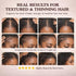 SUUDUUL Gummies (5000mg (30mcg), 60 Gummies Hair Growth for Black Women, with Biotin-Silica Complex Biotin) & Vitamin D