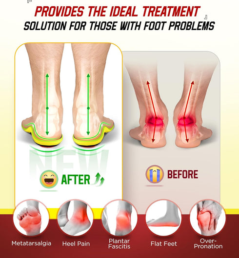 240+lbs Plantar Fasciitis Insoles - 100% Memory Foam Comfort, High Arch Support Inserts for Pain Relief, Orthotic for