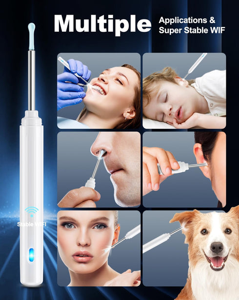 Ear Wax Removal Tool Camera, Ear Cleaner with Camera, Ear Cleaning Kit 1296P HD Ear Scope with 6 LED Lights and 6 Ear