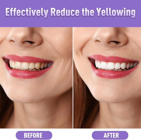 Teeth Whitening Pen (4 Pcs) - Whiten Teeth 40+ Uses, Remove Stains, Effective, Painless, Travel-Friendly Mint Flavor
