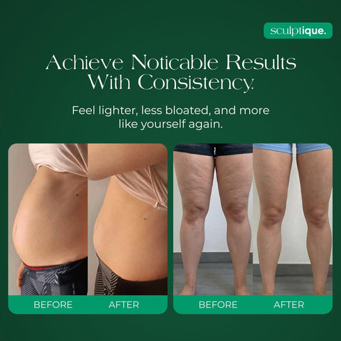 Sculptique 60 Lymphatic Drainage Supplement Lymphatic Drainage Capsules with Dandelion, Burdock, Cleavers & Echinacea