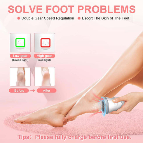 Professional Electric Feet Callus Remover, Portable Rechargeable Foot File with Vacuum Adsorption and 3 Grinding Heads