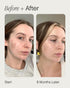 Topicals Faded Brightening and Clearing Serum, Reduces Discoloration, Contains Kojic Acid and Niacinamide