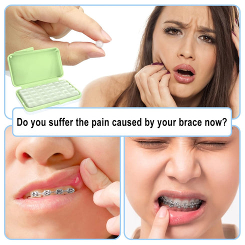 BVN Braces Wax Dental Wax, 10 Boxes Orthodontic Wax Strips, Relief Wax for Braces Wearers