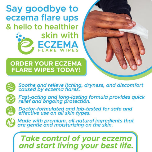Inflammation 72ct Eczema Flare Wipes - All-Natural Fast Acting Eczema Relief, Anti-Itch, Reduces & Protects Skin