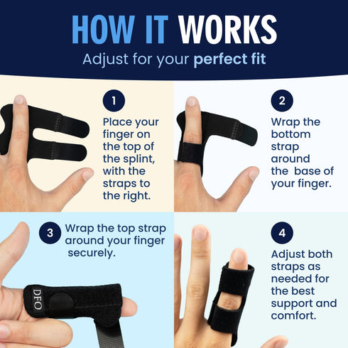 Dr. Frederick's Original Trigger Finger Splint - 2 ct - Adjustable Mallet Splint & Brace for Arthritis, Injury, & Sprain