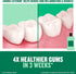 Listerine Freshburst Antiseptic Mouthwash, Kills 99% of Germs, Spearmint, 1 L, ADA Accepted
