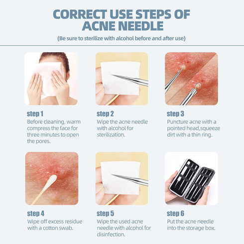 JPNK Blackhead Remover Comedone Extractor, Acne Removal Kit.