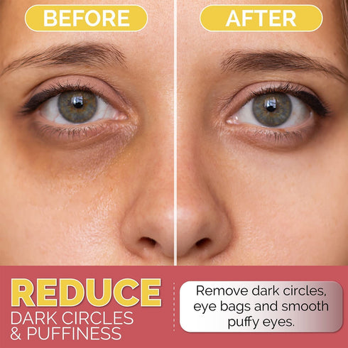 Under Eye Patches for Dark Circles, Puffiness with 24K Gold, Anti-Wrinkle Eye Gel Pads, 30pcs