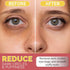 Under Eye Patches for Dark Circles, Puffiness with 24K Gold, Anti-Wrinkle Eye Gel Pads, 30pcs