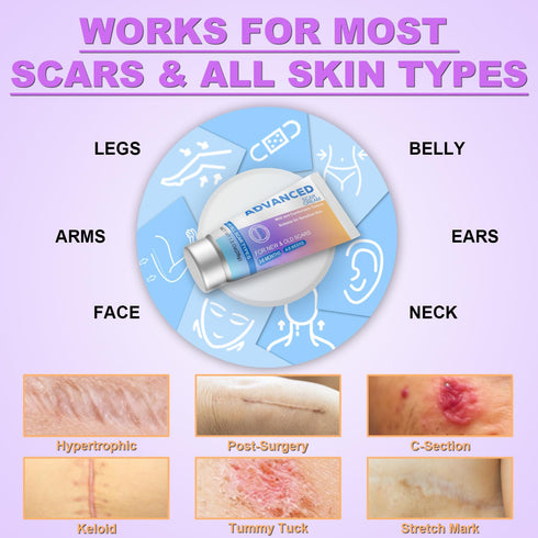 Voryn 1.23Oz (35g) Silicone Scar Cream Scar Gel - Advanced Scar Treatment Keloid Bump Removal for Surgical Scars