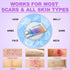 Voryn 1.23Oz (35g) Silicone Scar Cream Scar Gel - Advanced Scar Treatment Keloid Bump Removal for Surgical Scars
