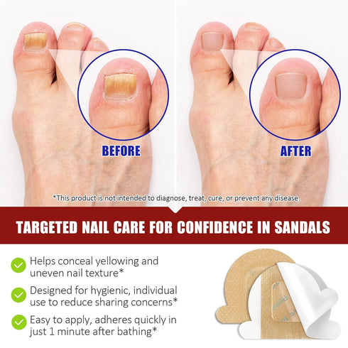 NIFEISHI (32pcs) Fungal Nail Patches for Toenails, Toenail Fungus Treatment Extra Strength for Overnight Toenail Care