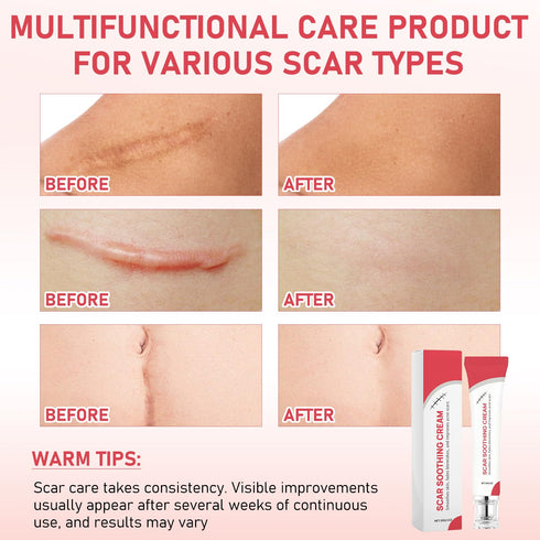 Silent Grind Pro 2 PCS Scar Soothing Cream - Gentle Care for Sensitive Skin, Helps Improve Appearance of Scars, Reduces