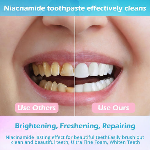 KUKSY (3) Niacinamide Whitening Toothpaste, Niacinamide Toothpaste Intensive Whitens Teeth, Protects Enamel, Removes
