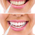 BBTO 100 Pcs Dental Brush Flosser - Interdental Brush Toothpick Cleaners for Oral Dental Care (Black, White)