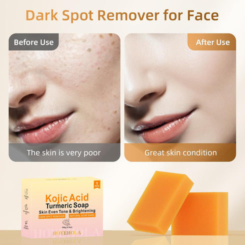 Kojic Acid Turmeric Soap Bar - Dark Spot Remover for Face, Even Skin Tone, Moisturizing Natural Ingredients