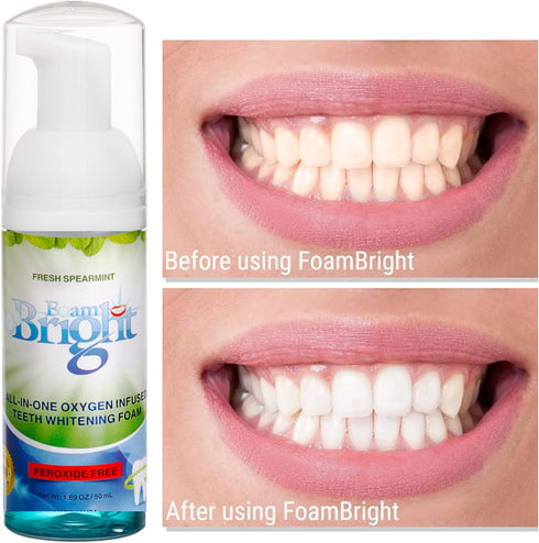 FoamBright Retainer & Aligner Cleaner, Great for Invisalign, Teeth Whitening, Denture Whitener, Peroxide Free Oral Care