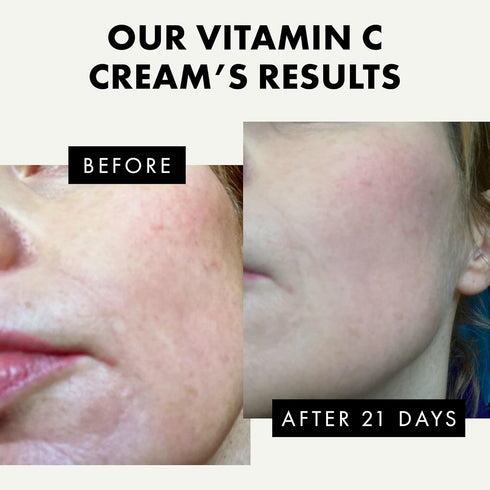 Vitamin C Face Cream - 2.5% Hyaluronic Acid + 2% Squalane, Brightening Moisturizer for Uneven Skin Tone