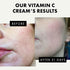 Vitamin C Face Cream - 2.5% Hyaluronic Acid + 2% Squalane, Brightening Moisturizer for Uneven Skin Tone