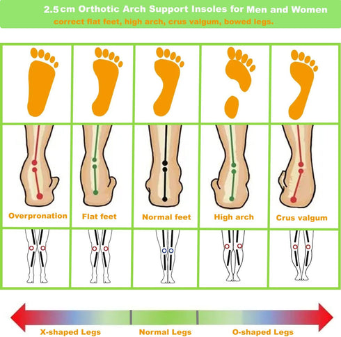 Thin Leather Insoles for Men, Arch Support for Pain Relief from Heel Spurs and Plantar Fasciitis, Brown, Women's