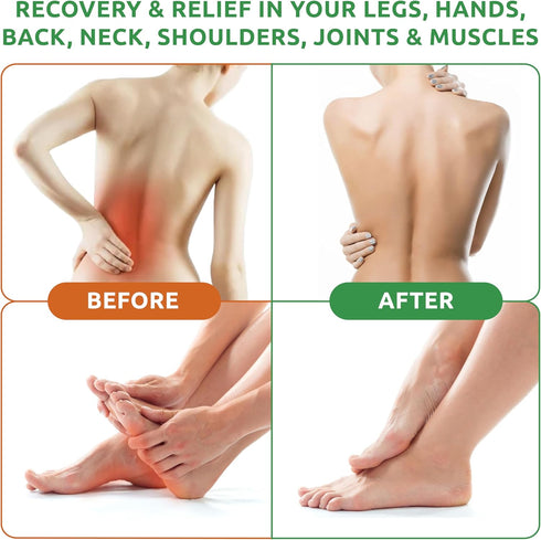 Neuropathy Pain Relief Cream - Maximum Strength Nerve Pain Reliever for Foot, Toes, Hands, Legs, 3oz