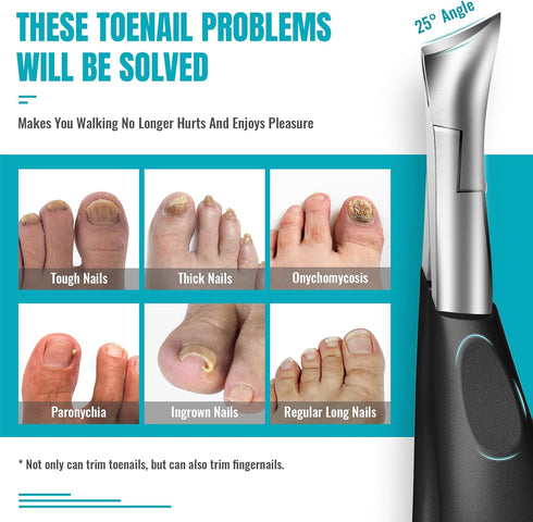 Toenail Clippers for Thick Nails for Seniors, Heavy Duty Toe Nail Clippers Kit with Long Handle for Men & Elderly