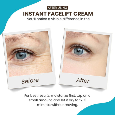 Instantly Ageless Instant Face Lift Cream, Anti Aging Skin Care, Wrinkle Tightener, 5 Vials