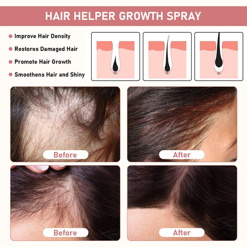 Bello Hair Helper Spray for Thinning Hair - Hair Growth Spray, Rice Water Spray, Restore Dry Damaged Hair, Unisex (2Pcs)