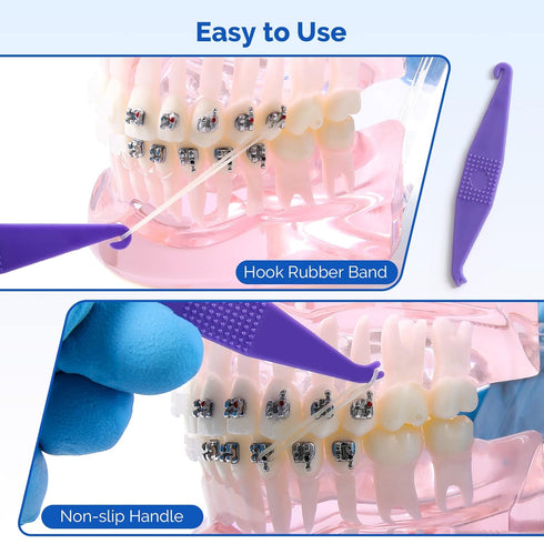 JMU Orthodontic Elastics 3/8 Heavy, 300 Pack of Rubber Bands, Intraoral Latex Dental Bands