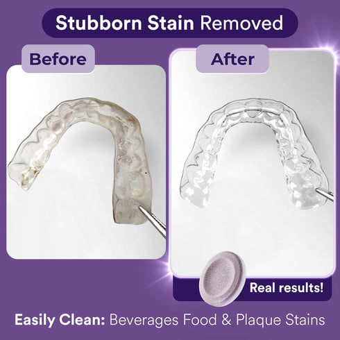 Retainer & Invisalign Aligner Cleaner Tablets, 60 Tablets, Grape-Scented, 2-Month Supply, Night Guard Cleaner