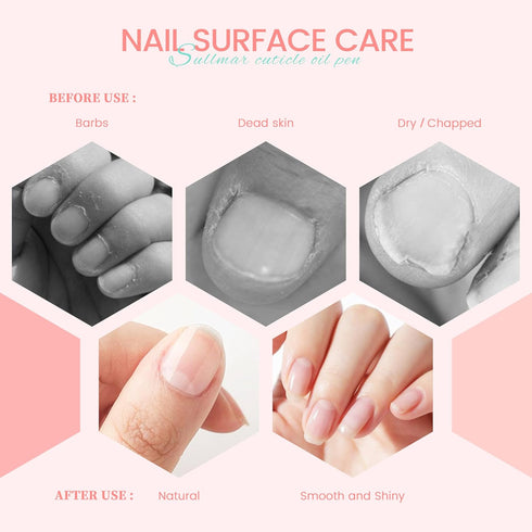 Nail Nutrition Oil Pen Set, 5pcs Cuticle Oil Pen for Nail Care at Home and Salon