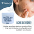 TreeActiv Invisible Acne Spot Treatment, 150+ Treatments with Salicylic Acid & Tea Tree Oil for Cystic Acne