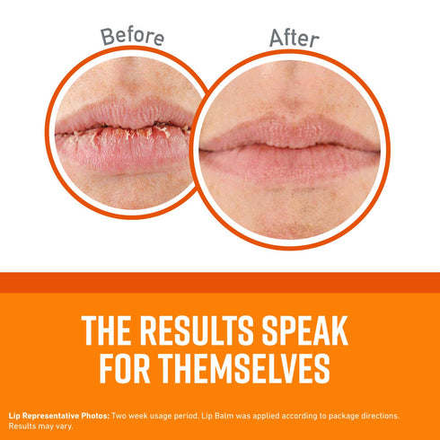 O'Keeffe's Unscented Lip Repair Balm for Dry, Cracked Lips, Stick, Pack of 2, Clear (K0700137)