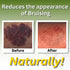 Relief Arnica Massage Oil for Therapeutic Massage Therapy, All Natural with Arnica Montana & Lemongrass