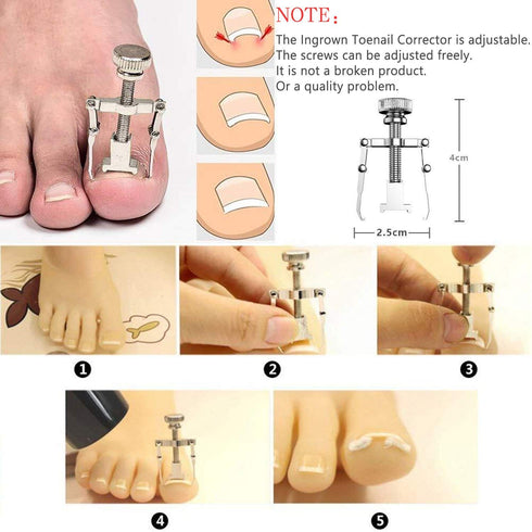 JTIEO 12-Piece Toenail Clippers Set - Heavy Duty Ingrown Toenail Removal Kit with Silver Finish