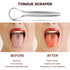 AILE Tongue Scraper, 100% Surgical Stainless Steel, Professional Metal Tongue Cleaner for Adults and Kids
