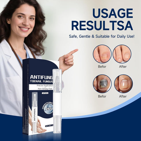 Nail Repair Pen with Lauric Acid and GlycerinStrengthens brittle nails, providing cooling relief for toenails