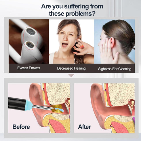 vasdaren 1296P, 9 Set 8 Ear Wax Removal, Ear Wax Removal Tool Camera Built-in Easy and Safe Ear Cleaning, Earwax